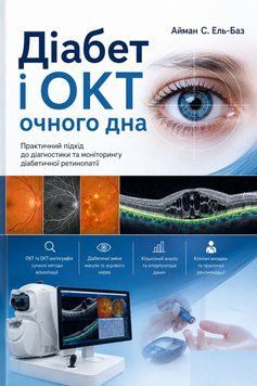 Диабет и ОКТ глазного дна Айман С. Эль-Баз 2020г. 67730-33 фото