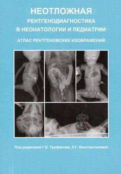 Невідкладна рентгенодіагностика в неонатології та педіатрії. Атлас рентгенівських зображень Г.Е. Труфанів 2020г 202012 фото
