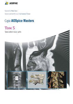 AOSpine Masters Том 5 Травма шийного відділу хребта Луїс Роберто Віалле 931851 фото