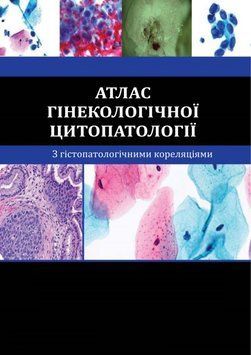 Атлас гінекологічної цитопатології з гістопатологічними кореляціями Крістофер Дж. ВанденБуше 2016р. 4395544 фото