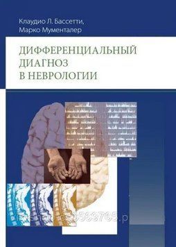 Дифференциальный диагноз в неврологии Марко Мументалер 2017г. 954651 фото