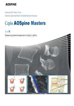 AOSpine Masters Том 6 Травма грудинно-поперекового відділу хребта Луїс Роберто Віалле 9835113 фото