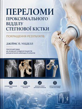 Переломи проксимального відділу стегнової кістки: Покращення результатів  Джеймс П. Уодделл 710742 фото