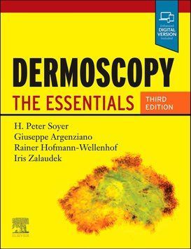 Dermoscopy The Essentials 3rd Edition H. Peter Soyer 30921 фото