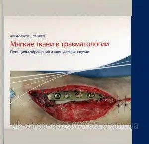 М'які тканини в травматології. Принципи звернення та клінічні випадки Волгас Девід 2016г. 68322 фото