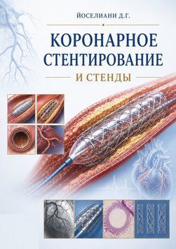 Коронарное стентирование и стенды Йоселиани Д.Г. 4892-88 фото