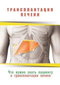 Трансплантація печінки. Що потрібно знати пацієнтові 2020р. 2522222 фото